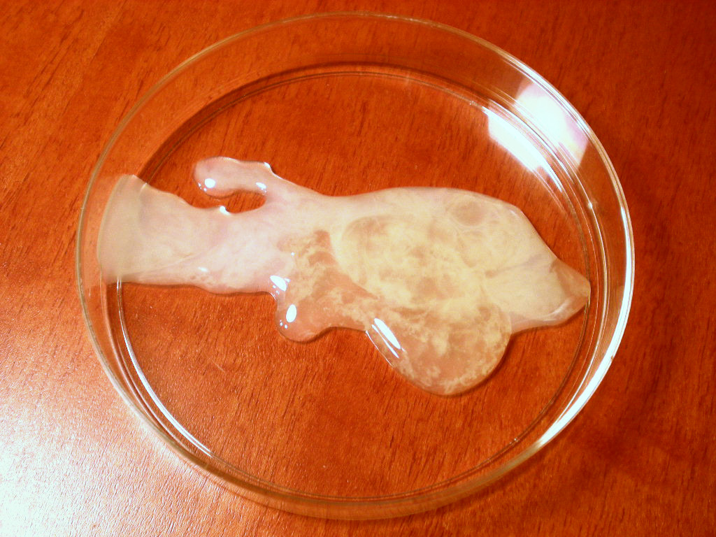 http://de.academic.ru/pictures/dewiki/104/human_semen_in_petri_dish2.jpg