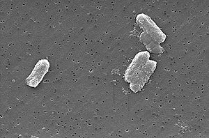 Citrobacter freundii(sekundärelektronenmikroskopische Aufnahme)