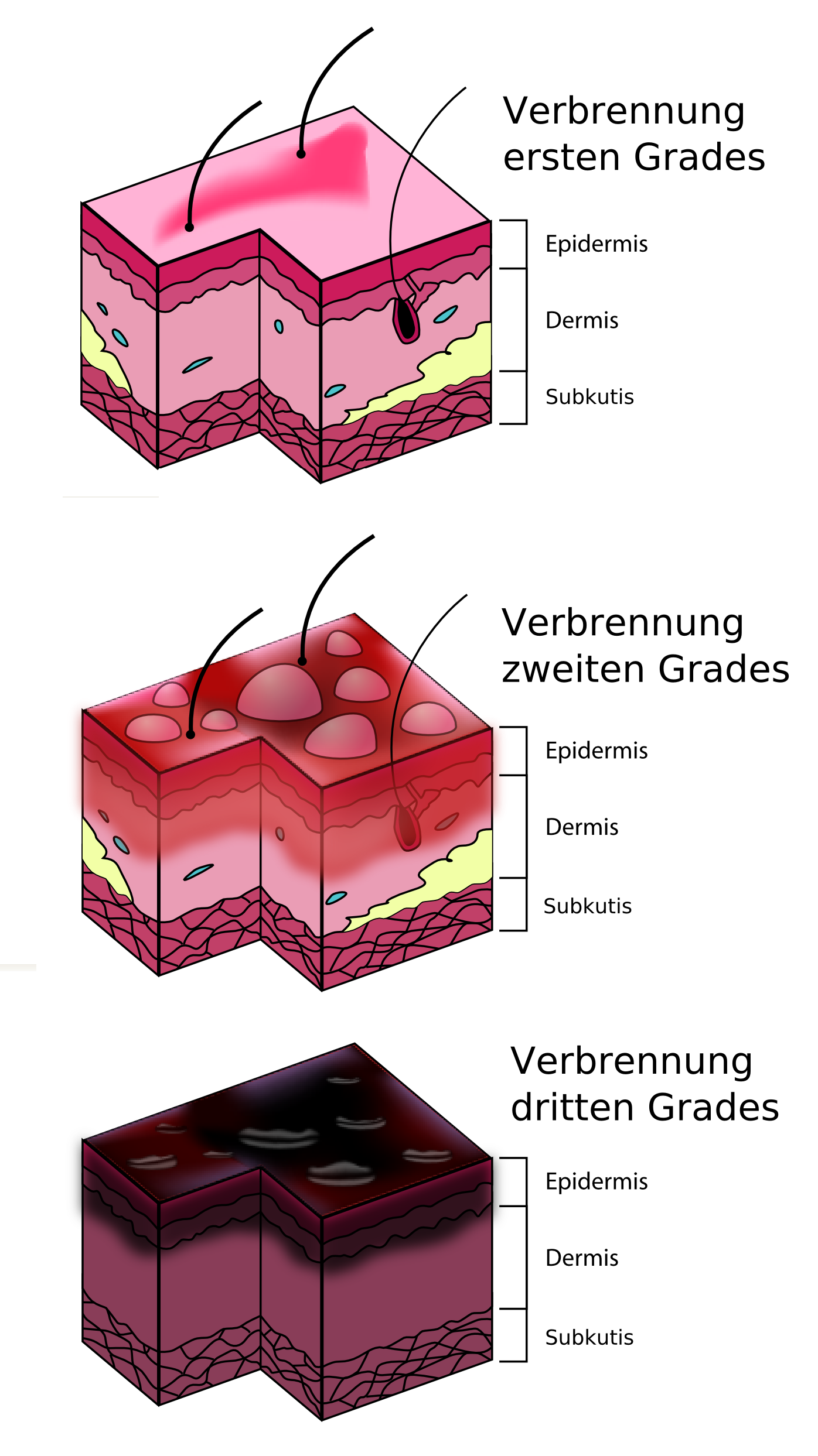 BaxterFormel