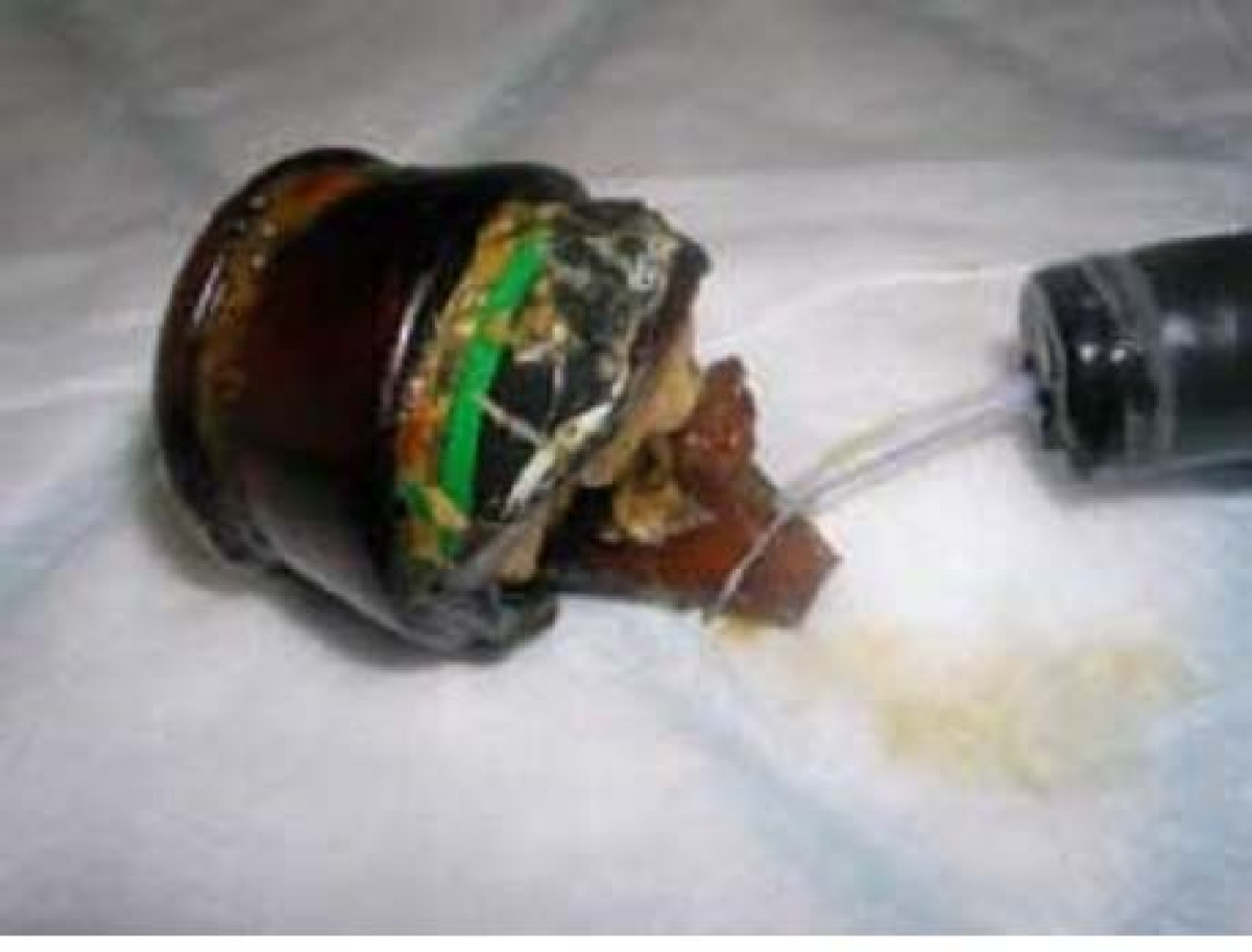 beautiful british girl naked foreign object in anus