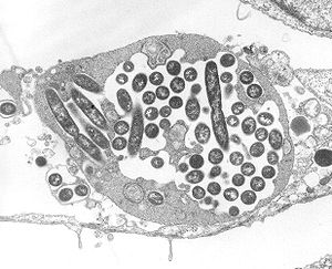 Legionella pneumophila in einem Lungenfibroblasten