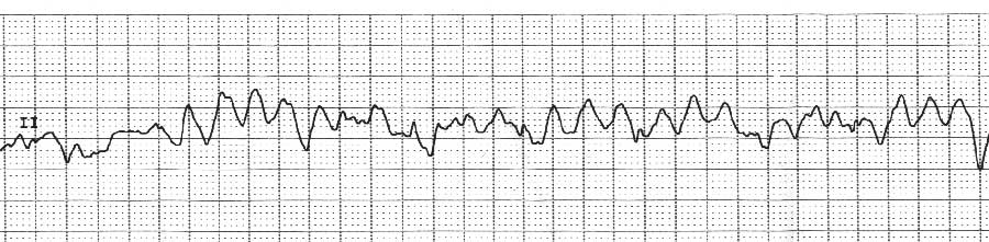 Acls 考題 Acls 考題